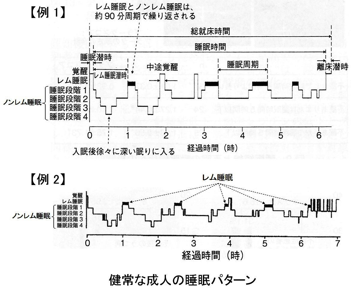 �����p�^�[��